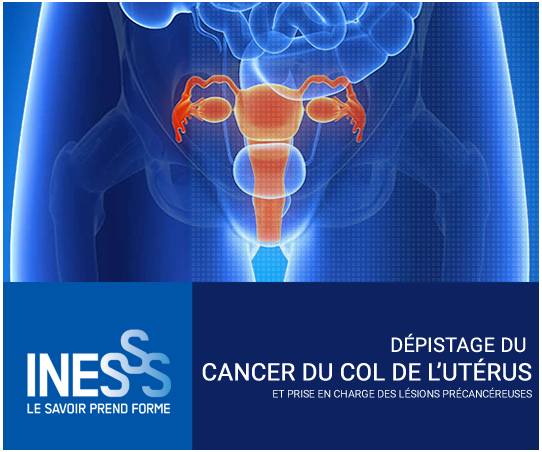 Cancer du col de l'utérus